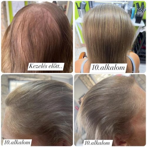 Raywell BIO TEA – Hajnövesztő és Hajhullás elleni ampulla, Nőknek